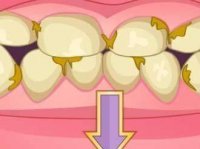 Bad Teeth Makeover Online Game